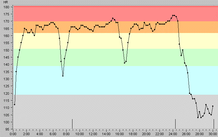 heart rate